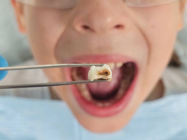 Best Cosmetic Emergency Dentistry in Denton, NC